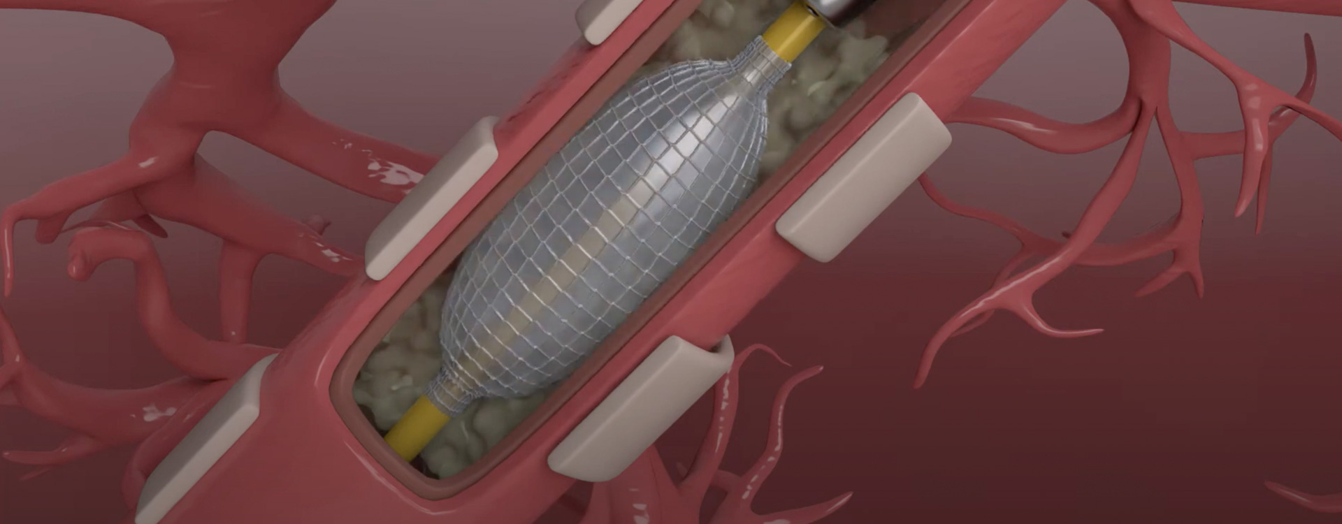 clinodevice_banner_copd